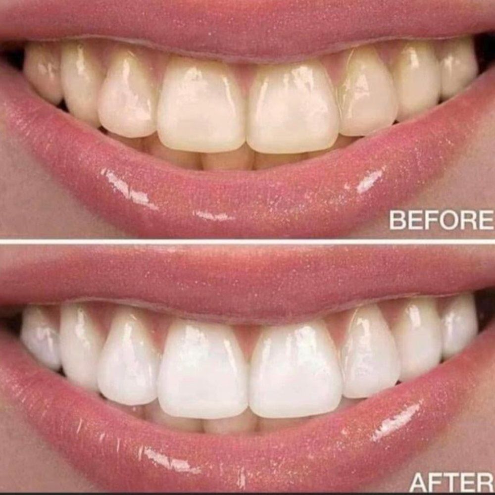 NUSKIN AP24 Whitening Toothpaste